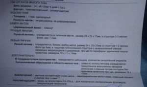 Можно ли делать УЗИ малого таза на 15 день цикла?