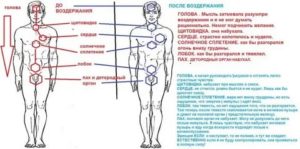 Жжение в области солнечного сплетения