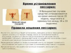 Как ухаживать за пессарием дома?