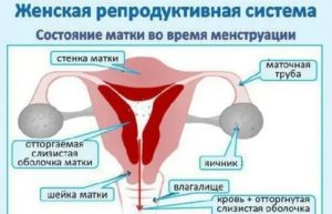 Что может служить причиной задержки менструации у девственницы?