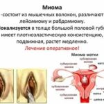 Синусит и цистит при беременности
