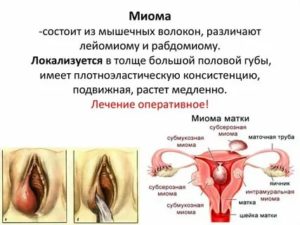 Опухла левая половая губа, что это может быть?