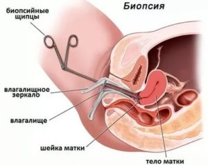 Как гинеколог проверяет состояние матки?