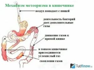 Боли в кишечнике при прохождении газов