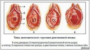 Беременность при лишении девственности без ПА