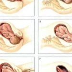 Какие первые признаки беременности после ПА?