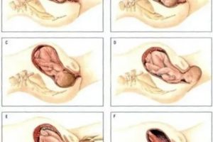 Как можно ускорить процесс родов?