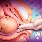 Каковы причины рвоты на 34  неделе беременности?