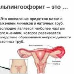 Положительный тест на фоне менструации