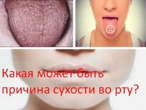 Какая может быть причина?