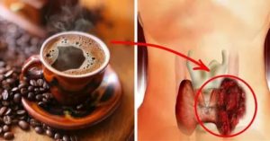 Влияет ли кофе на щитовидку?