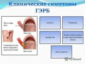 Икота и изжога