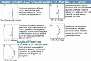 Почему в 14 лет не растёт грудь?