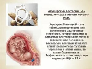 На какой неделе беременности можно ставить пессарий при ИЦН?