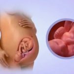 Тонус матки на 20-й неделе беременности