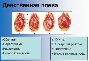 Повреждение девственной плевы