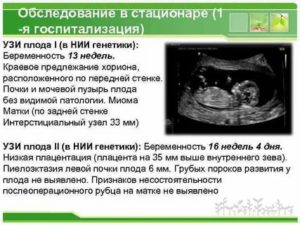 Опасно ли полное предлежание хориона на 13 недели беременности?
