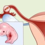 Напряжение мышц живота при беременности