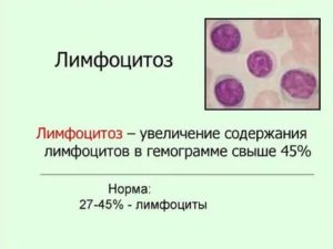 Лимфоцитоз с плазматизацией отдельных лимфоцитов