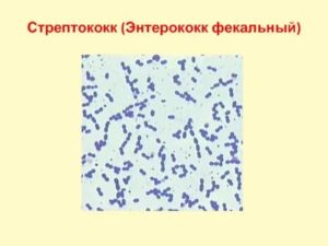 Обнаружили стрептококк в мазке