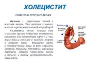 Изжога и воспаление желчного пузыря