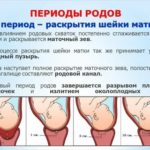 Подозрение на внематочную беременность
